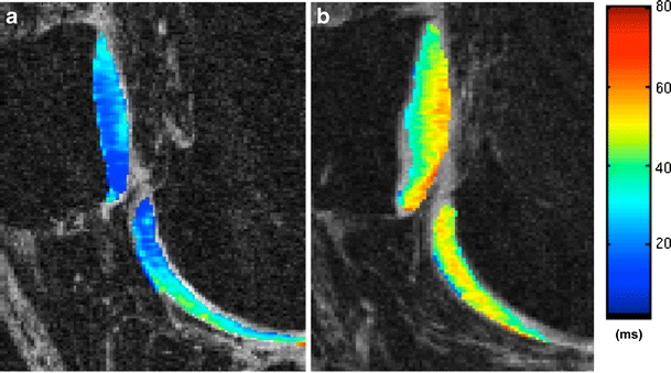 Fig. 13