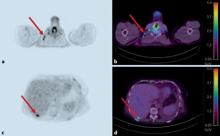 graphic file with name 761_2021_983_Fig3_HTML.jpg