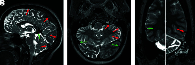 FIG 1.