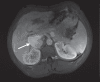 Figure 2)