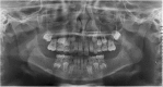 Fig. 9