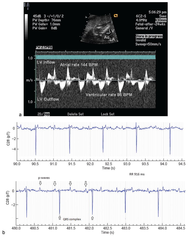 Fig. 4