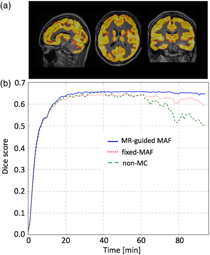 FIGURE 6