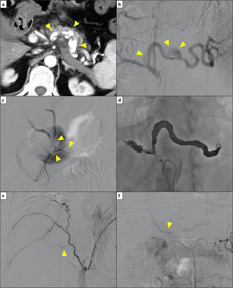 Fig. 4