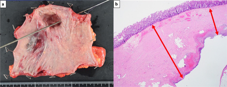 Fig. 3