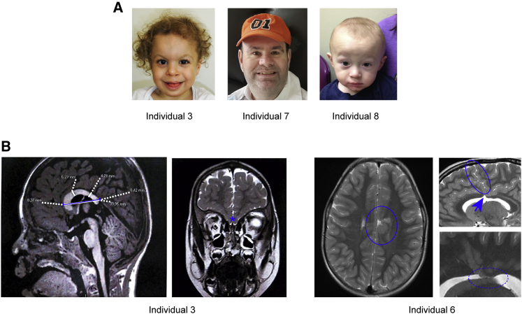 Figure 3