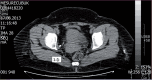 Figure 1d