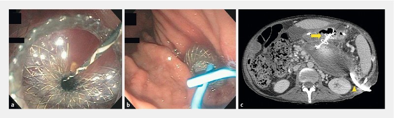 Fig. 1 a