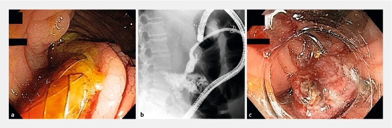 Fig. 3 a