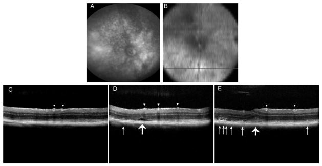 Fig. 4