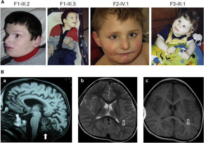 Figure 2