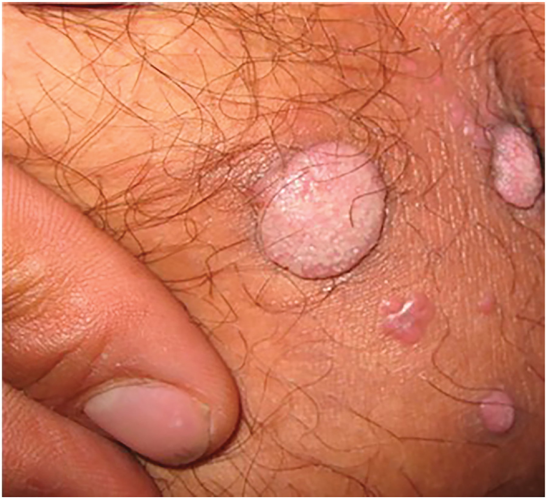 FIG 3.