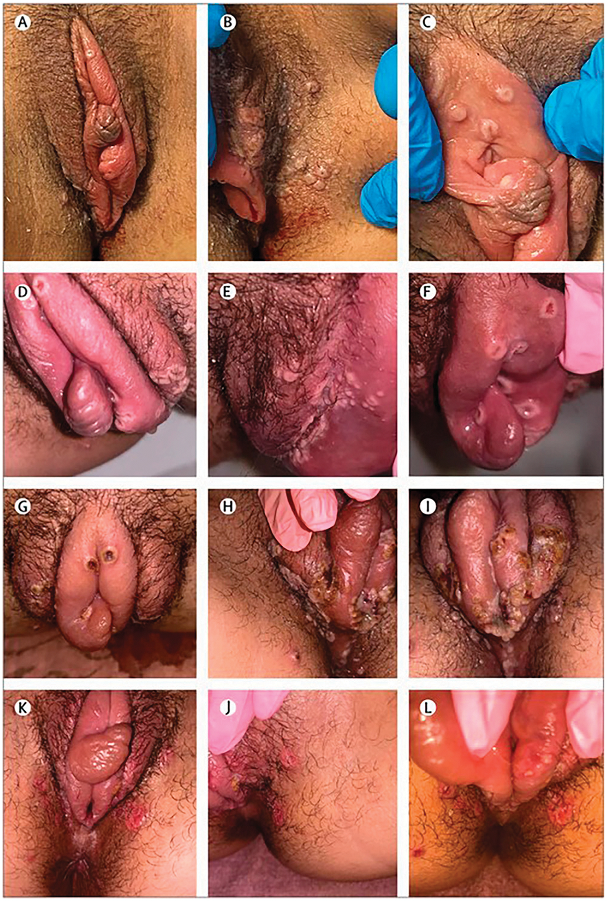 FIG 5.