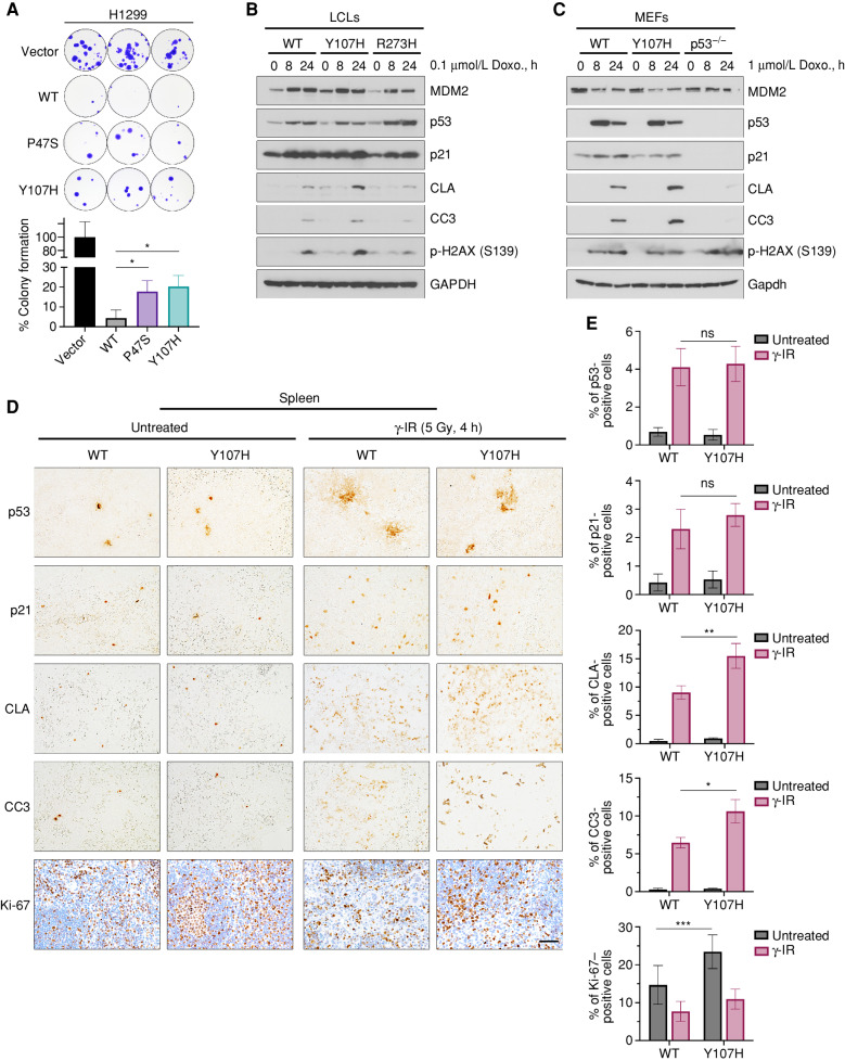 Figure 1. Impaired colony suppression but increased apoptosis in Y107H cells and tissues. A, Colony formation assays in H1299 cells transfected with CMV vector, WT p53, or expression constructs containing the P47S or Y107H variant. Quantification of percent colony formation ± SD of triplicate wells from the same experiment. B, Human LCLs containing either WT p53, heterozygous for the Y107H variant (Y107H/WT), or heterozygous for R273H (R273H/WT) were treated with 0.1 μmol/L doxorubicin (Doxo) for 0, 8, or 24 hours and assessed by immunoblot for the indicated antibodies. C, Homozygous WT, Y107H, or p53−/− MEFs were treated with 1 μmol/L doxorubicin for 0, 8, or 24 hours and assessed by immunoblot for the indicated antibodies. D, Representative IHC from Hupki WT mice and Y107H variant mice irradiated with 5 Gy after 4 hours (n = 3 mice per condition) and stained with the indicated antibodies. Scale bar, 50 μm. γ-IR, gamma radiation. E, Percentages of positive cells from IHC of WT and Y107H mice in D. Averages ± SEM from at least three random images from n = 3 mice per condition. *, P < 0.05; **, P < 0.01; ***, P < 0.001; ns, not significant, two-tailed unpaired t test.