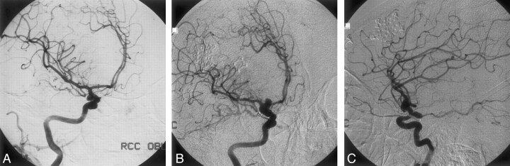 Fig 2.