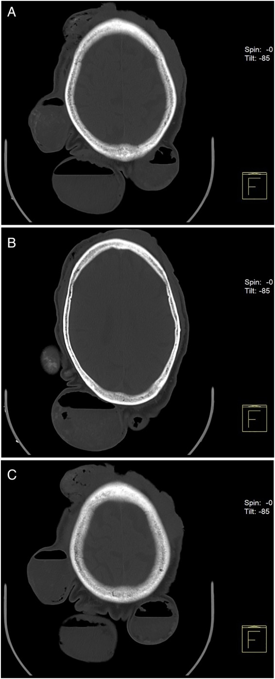 Figure 5