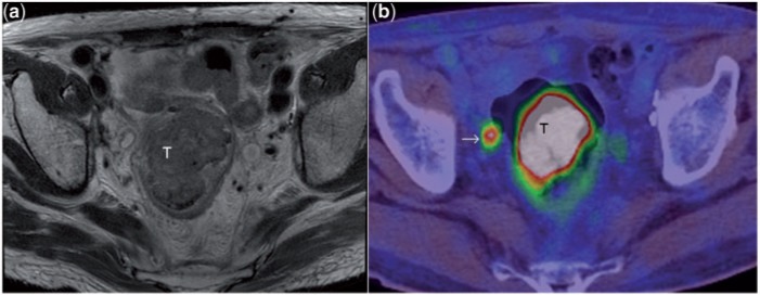 Figure 14