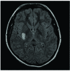 Fig. (1)