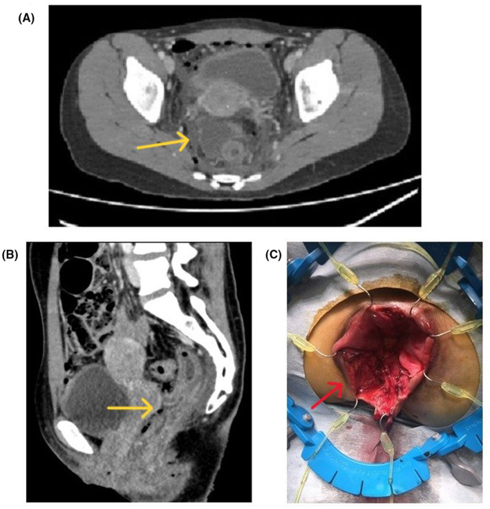 FIGURE 1