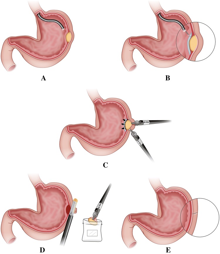 Fig. 2