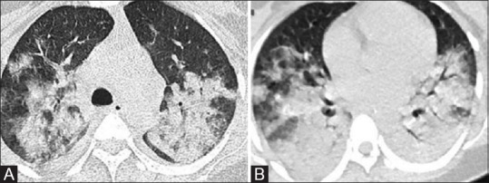 Figure 2(A and B)