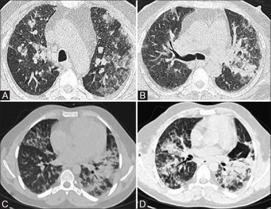 Figure 1(A-D)