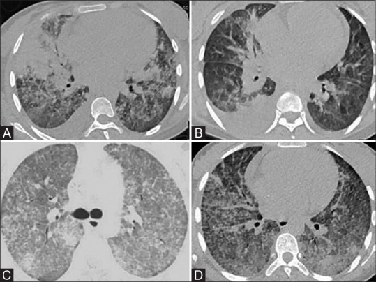 Figure 6(A-D)