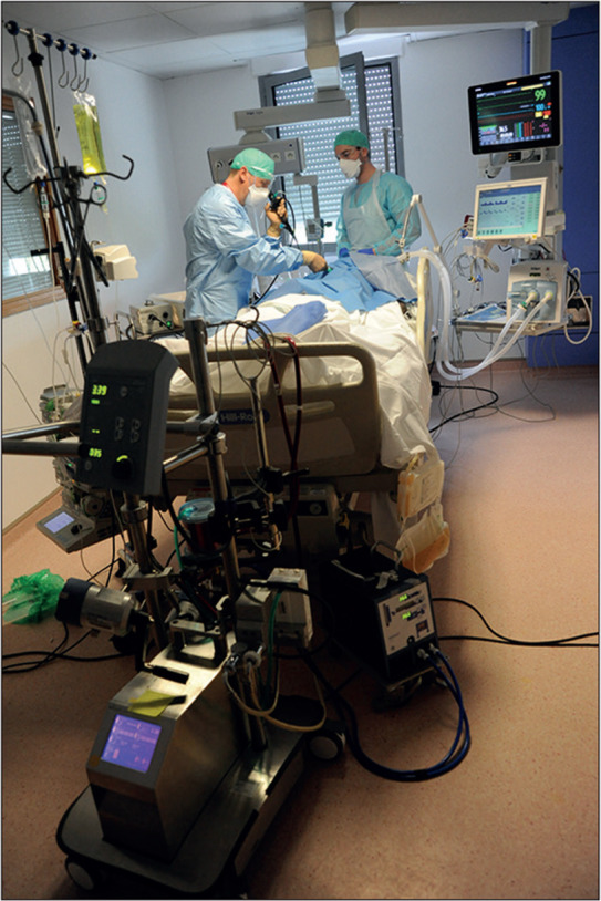 editorial use only Fibroscopy performed on an intubated patient and under ECMO (oxygenation by extracorporeal membrane) suffering from Covid-19. Medical resuscitation service, Jacques Cartier Hospital, Massy.