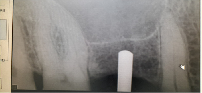 Fig. 5