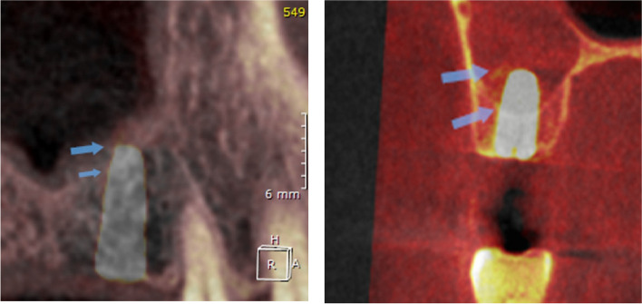 Fig. 17