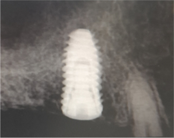 Fig. 14