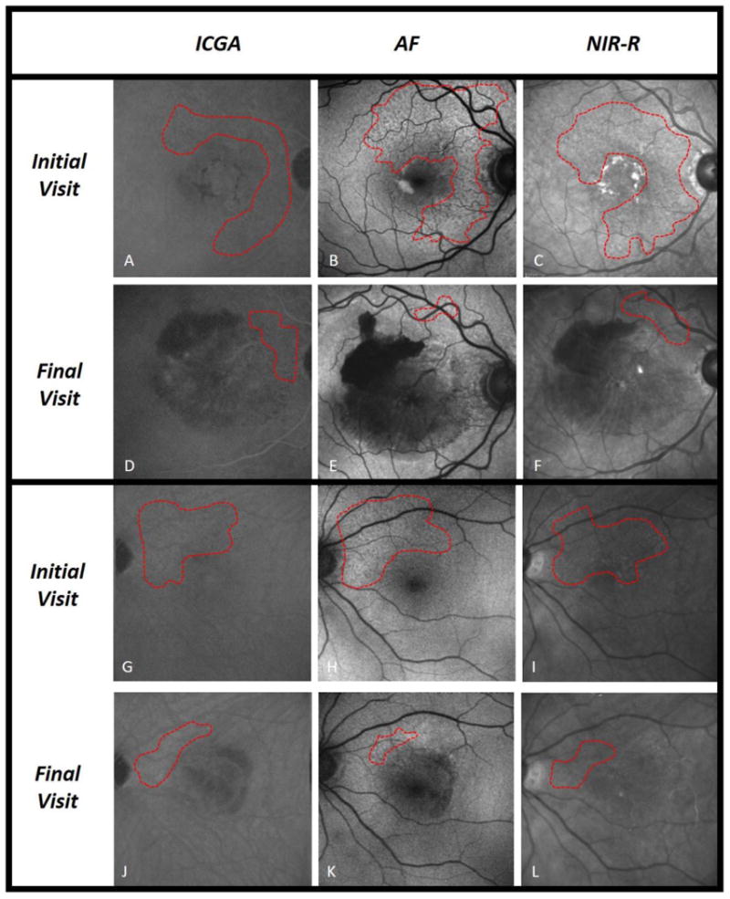 Fig. 1