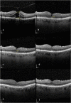 Fig. 9