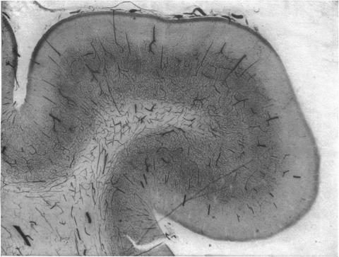 Fig. 11