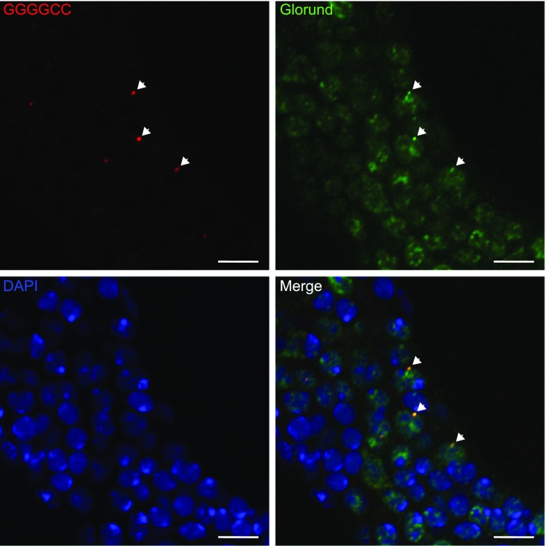 Fig. 4