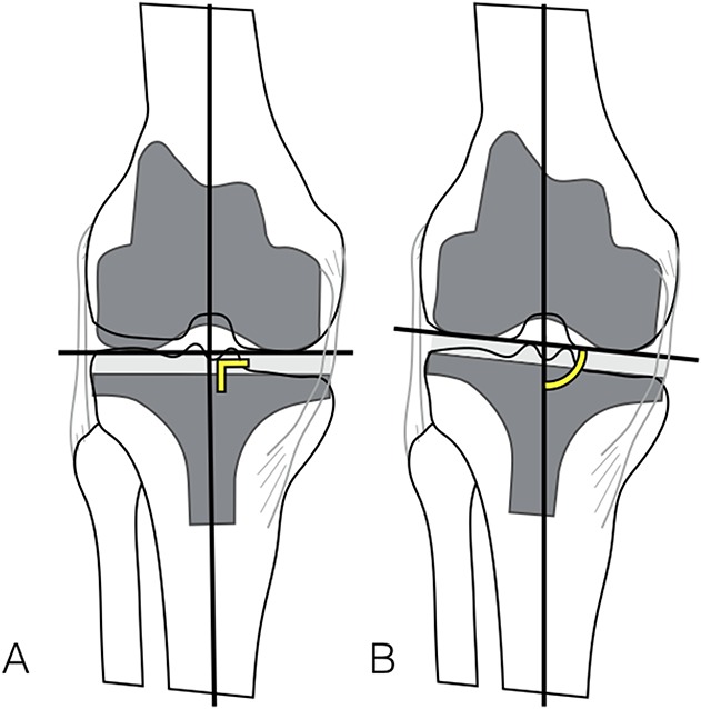 Fig. 1A-B