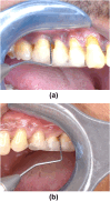 Fig. 4