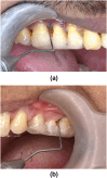 Fig. 3