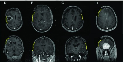 FIG. 6.