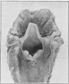 1562-1