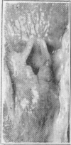 1562-1