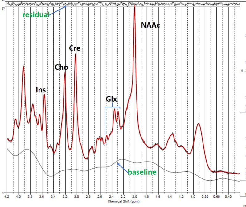 Fig. 2