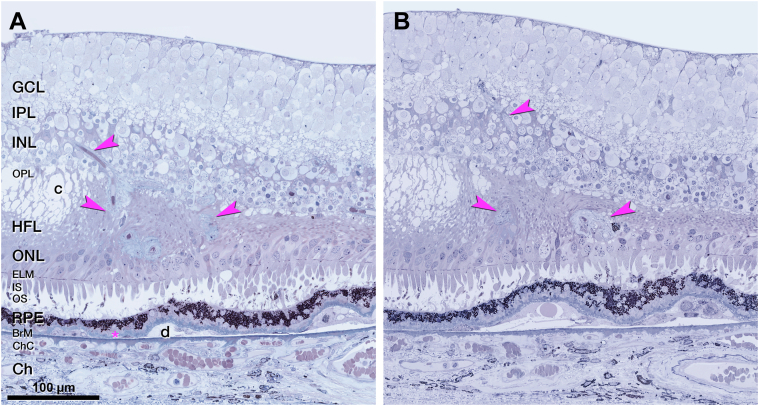 Figure 16