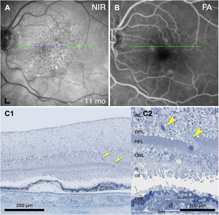 Figure 11