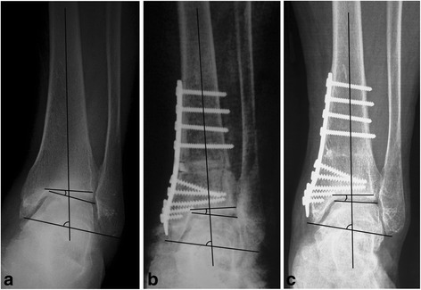 Fig. 6