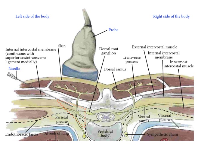 Figure 19