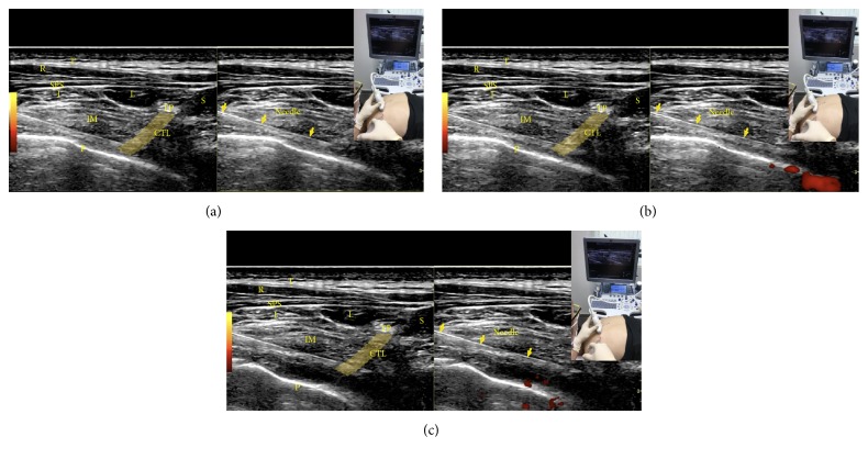 Figure 21