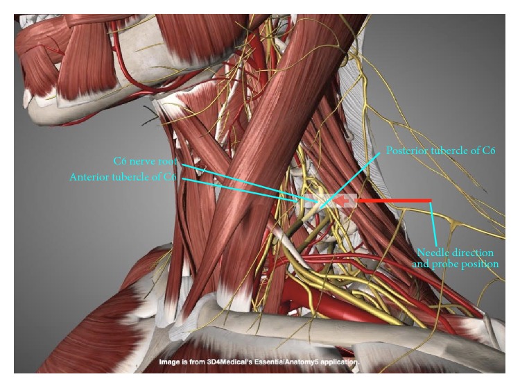 Figure 15