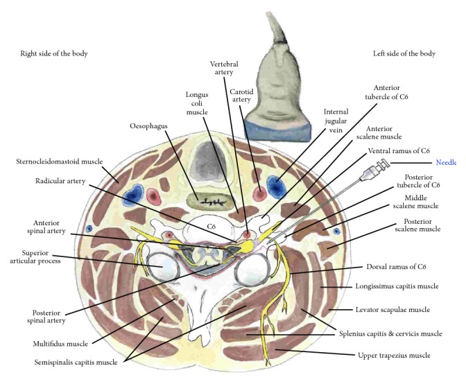 Figure 14