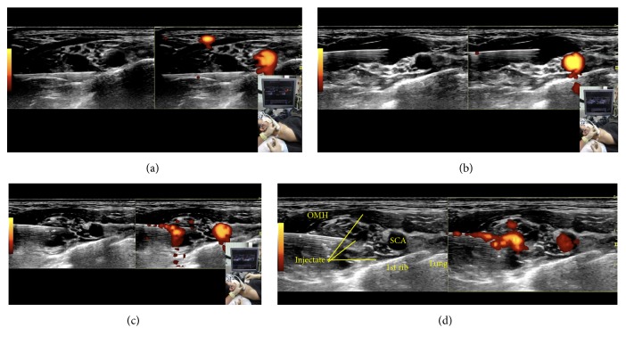 Figure 13